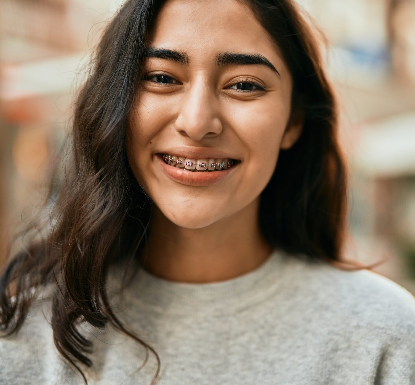 Young Woman with Braces - Dentist in San Fernando A smiling young woman outdoors proudly showing her braces - Dentist in San Fernando