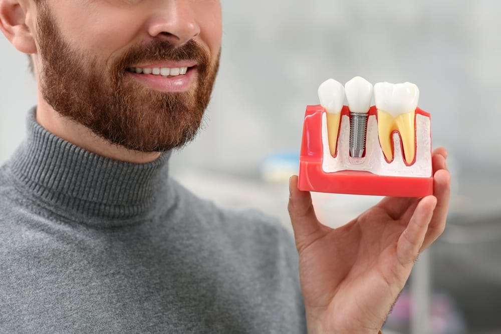Man Holding Dental Implant Model – Dental Implants in San Fernando, CA A smiling man holds a detailed dental implant model, demonstrating how implants restore missing teeth with strength and stability – Dental Implants in San Fernando, CA.