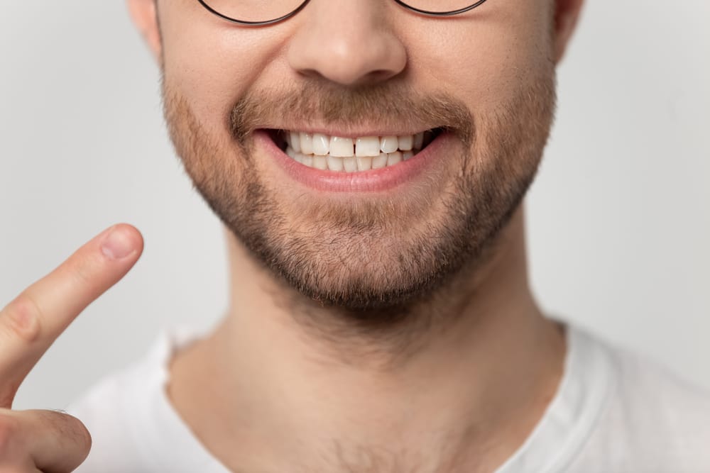 Close-Up of Man Pointing to His Bright Smile – Dental Implants in San Fernando, CA A close-up view of a man smiling confidently while pointing to his teeth, showcasing a healthy, restored smile – Dental Implants in San Fernando, CA.